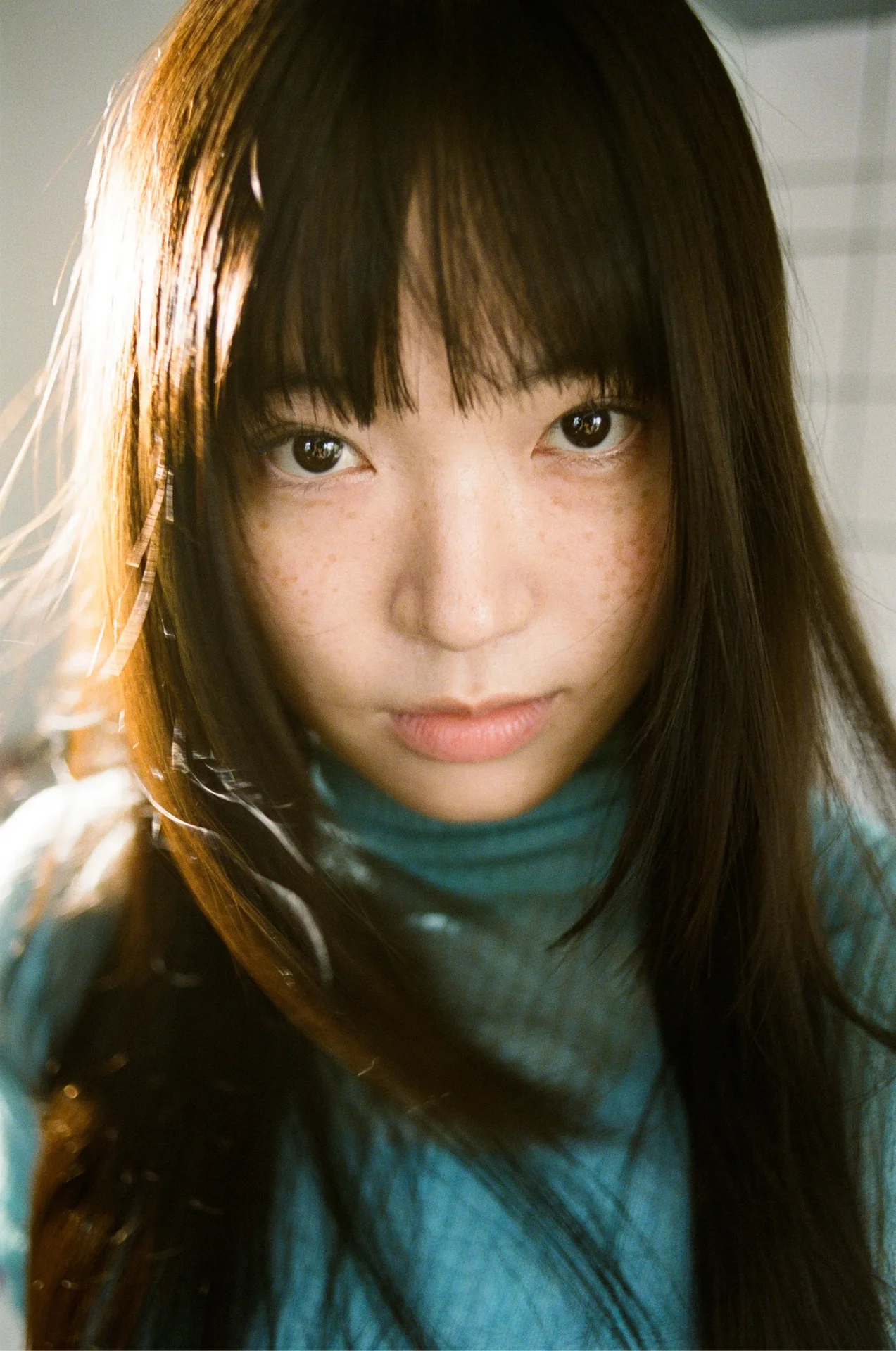 X TREATMENT IMAGE / 1